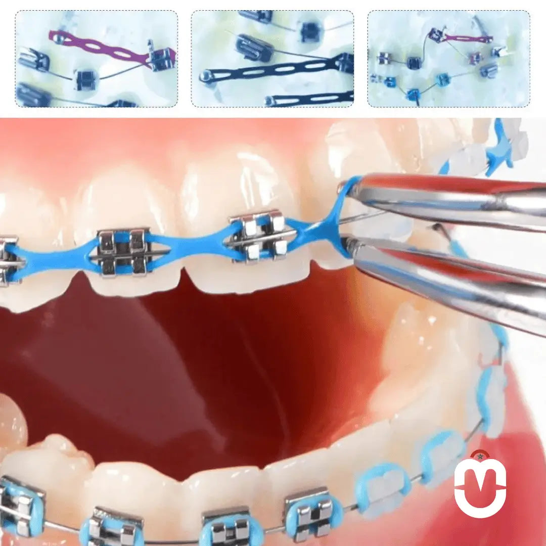 Décoration Dentaire Temporaire – Style Orthodontique - Univers Maroc