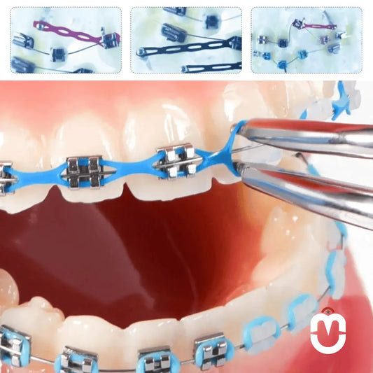 Décoration Dentaire Temporaire – Style Orthodontique - Univers Maroc