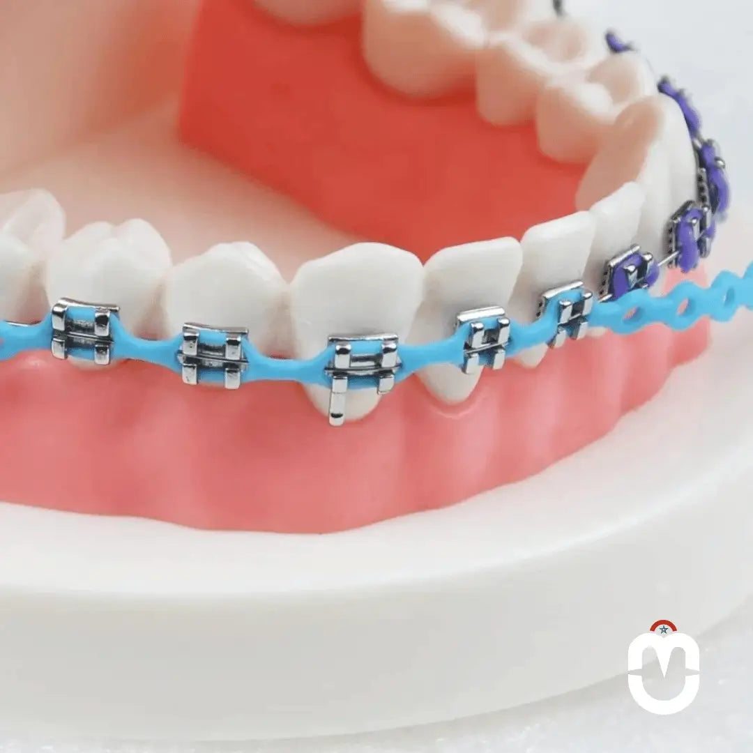 Décoration Dentaire Temporaire – Style Orthodontique - Univers Maroc
