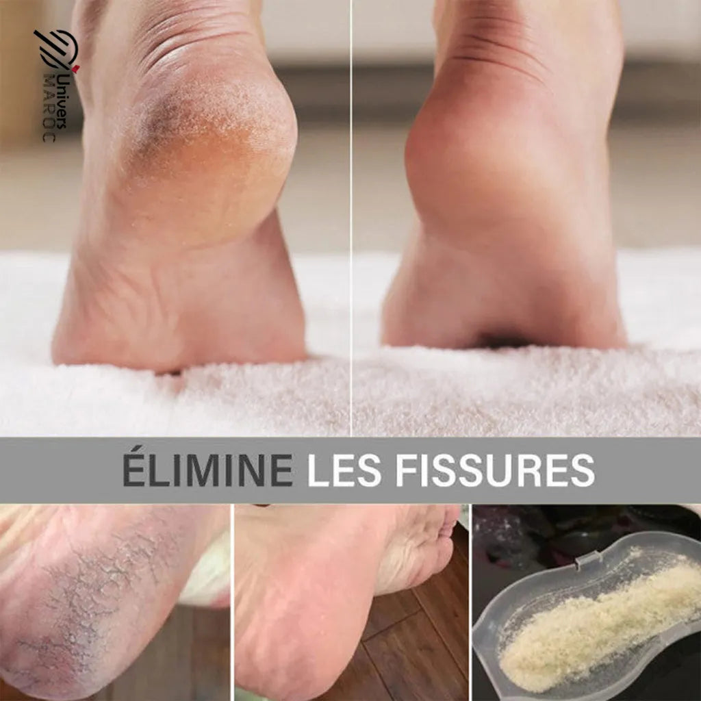 Lime À Pied Électrique Pour Nettoyage De La Peau Dure Et Morte De Talons Et Ongles À 2 Rouleau - Univers Maroc