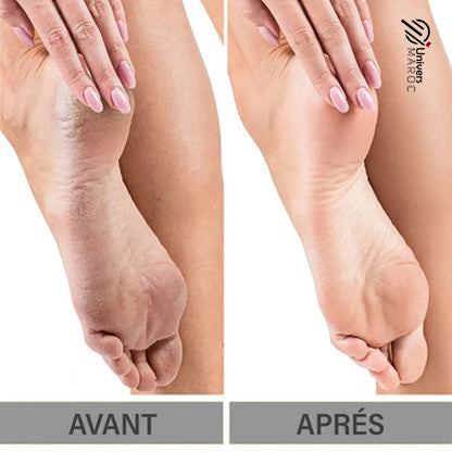 Lime À Pied Électrique Pour Nettoyage De La Peau Dure Et Morte De Talons Et Ongles À 2 Rouleau - Univers Maroc